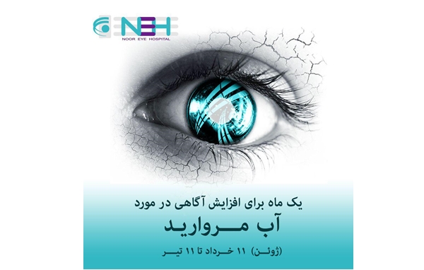 همه باهم کاتاراکت را بشناسیم و به موقع درمان کنیم