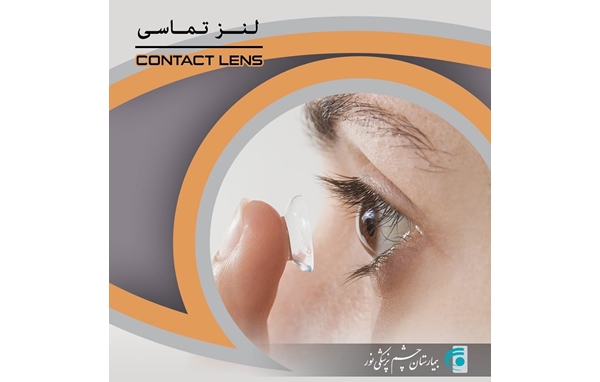 چه کسانی کاندید استفاده از لنزهای تماسی هستند؟